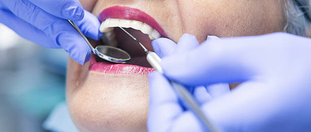 Best Emergency Dentist for Knocked-Out Tooth in San Antonio Heights, CA